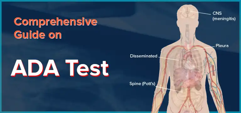 Comprehensive Guide on ADA Test